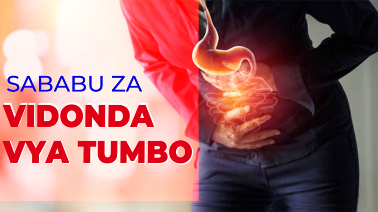 vidonda vya tumbo 768x432 (1)