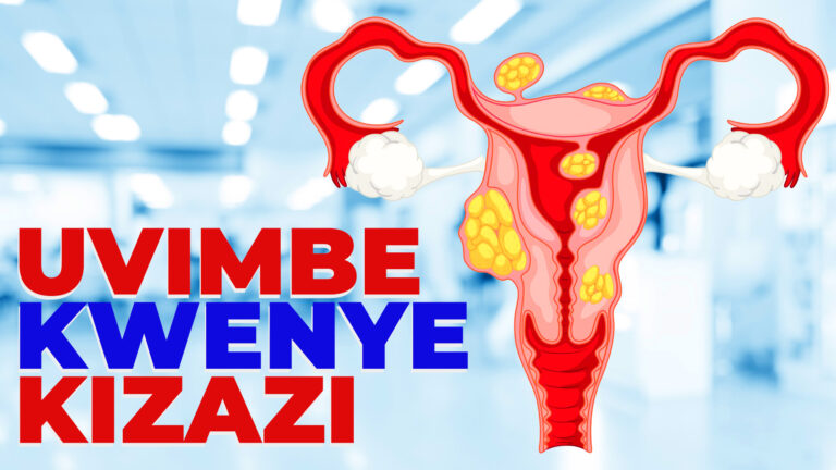 uvimbe kizazi 768x432